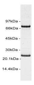 SDS-PAGE (KIT-32H).jpg